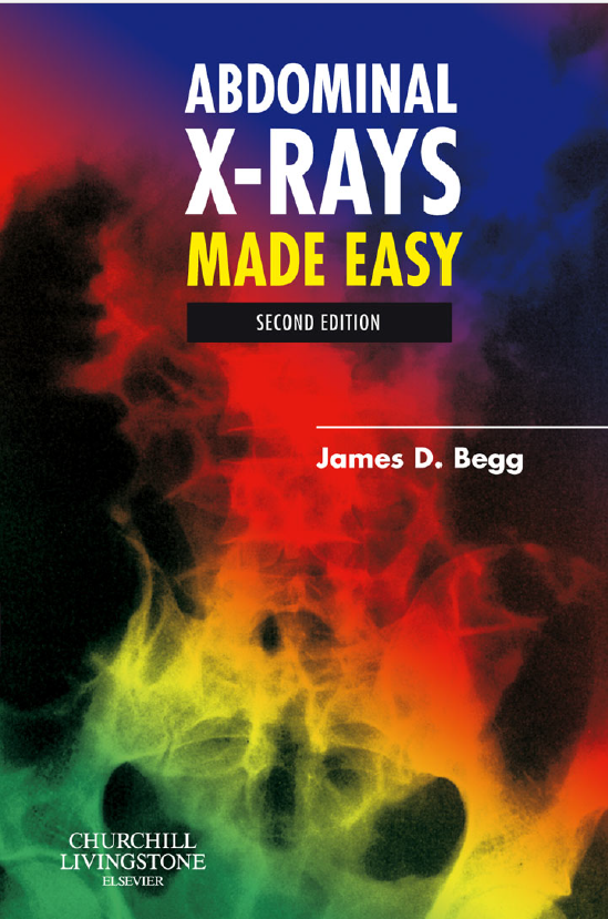 ABDOMINAL X-RAY MADE EASY