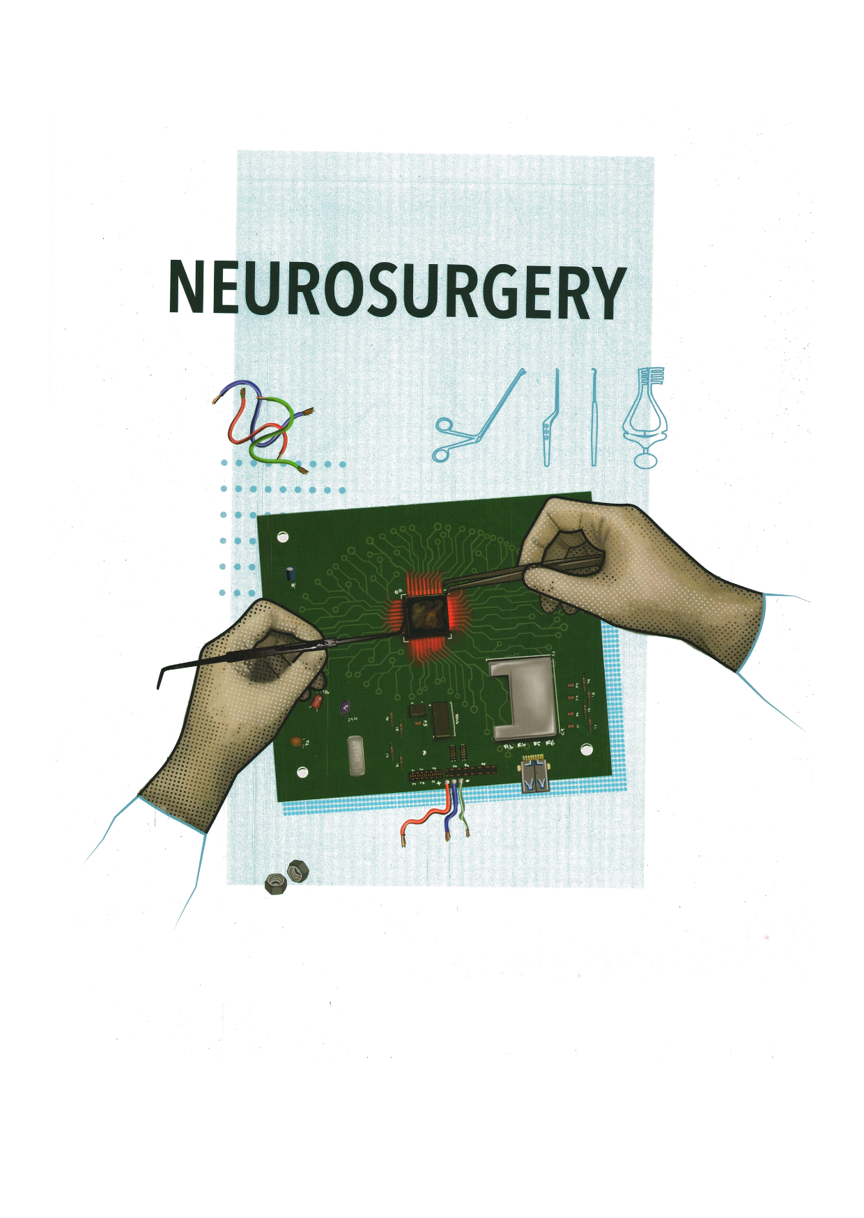 NEUROSURGERY - Surgery Neet SS Notes 2026