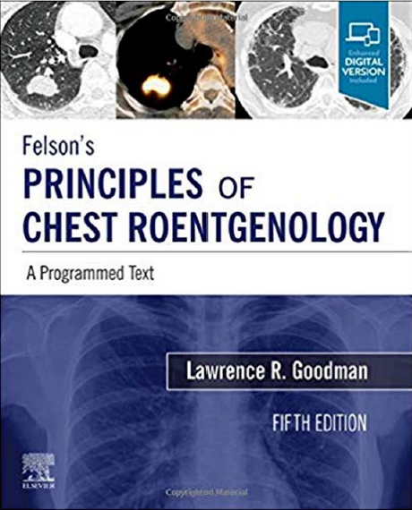 Felson's Principles of Chest Roentgenology