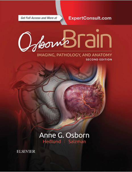 OSBORN'S BRAIN, 2ND EDITION