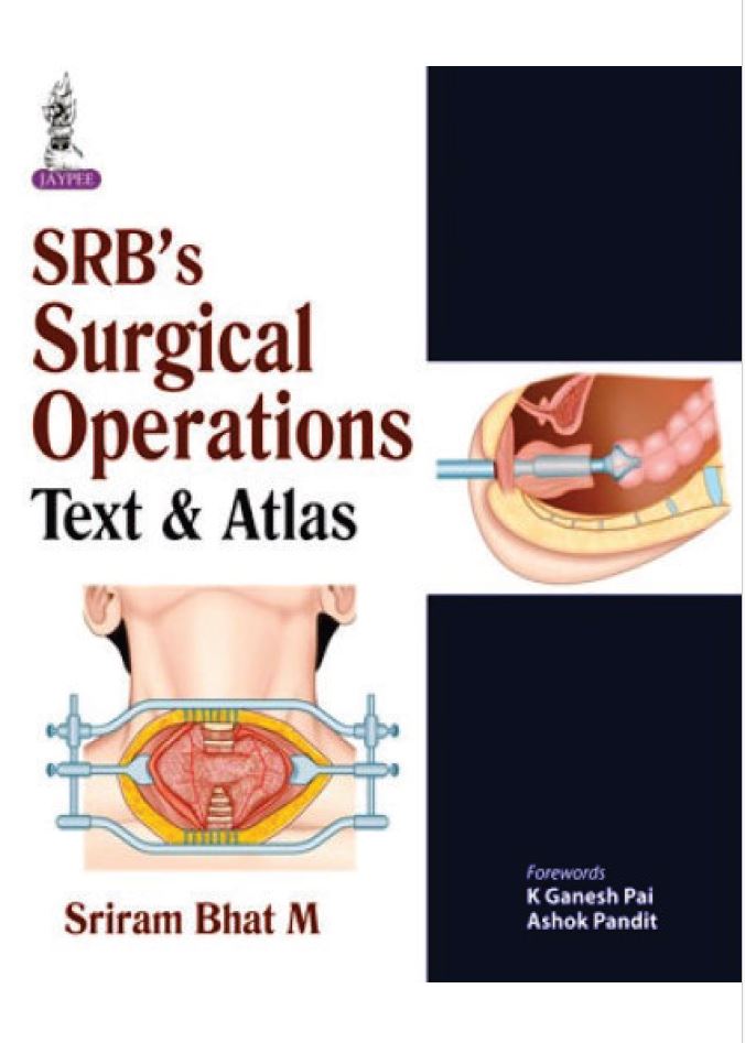 SRB’s Surgical Operations