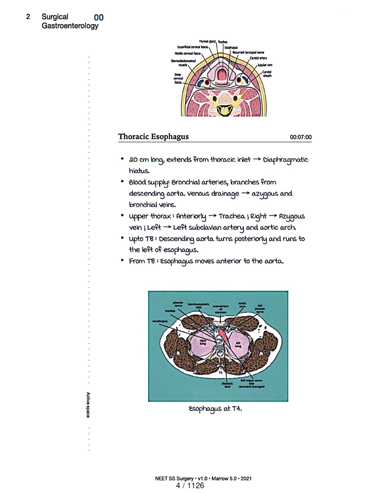 Surgery Neet SS - Gastro Surgery - PrintDoc