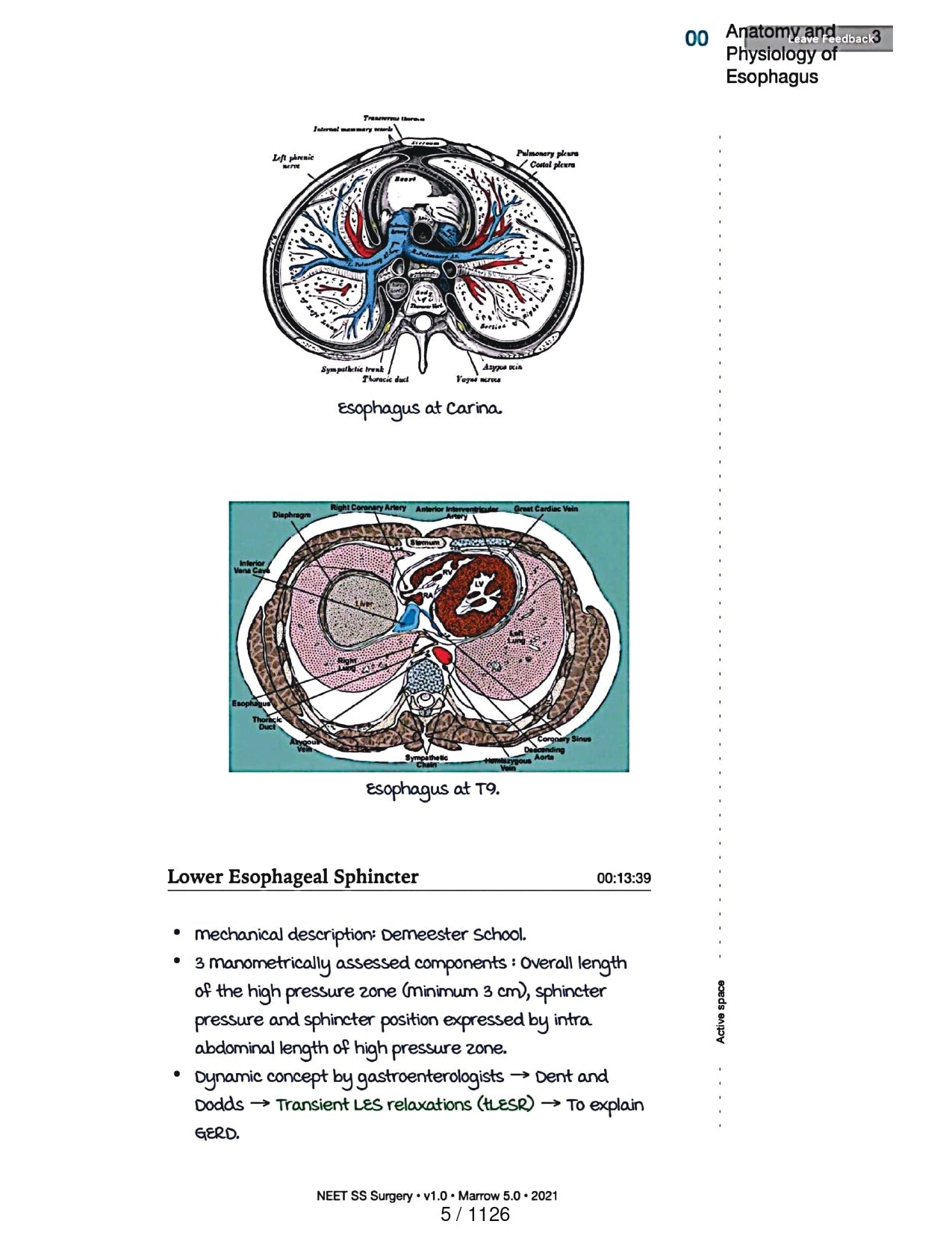 Surgery Neet SS - Gastro Surgery - PrintDoc