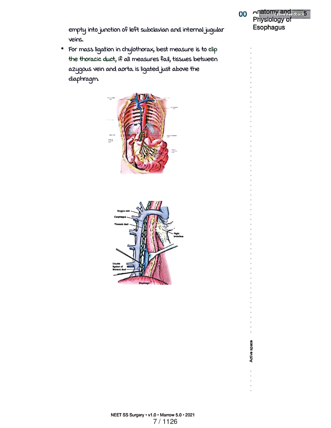 Surgery Neet SS - Gastro Surgery - PrintDoc
