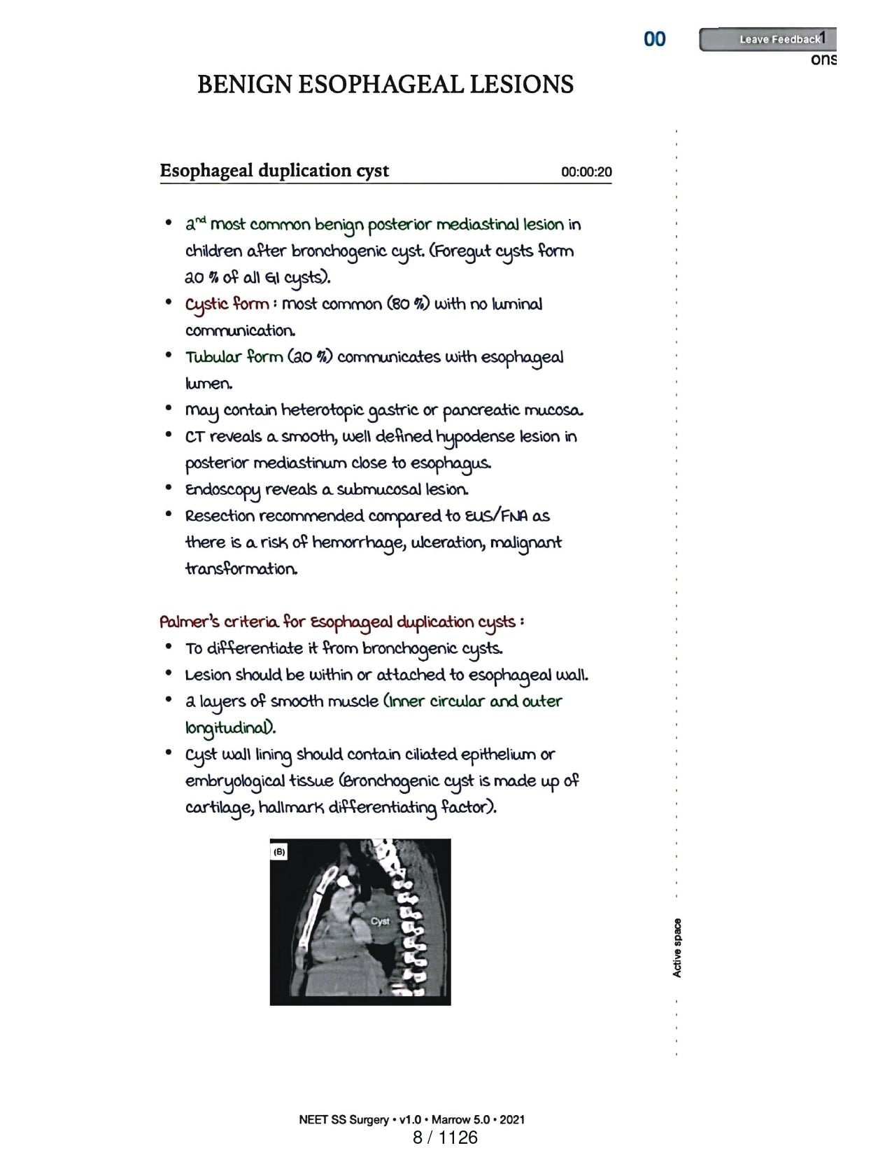 Surgery Neet SS - Gastro Surgery - PrintDoc