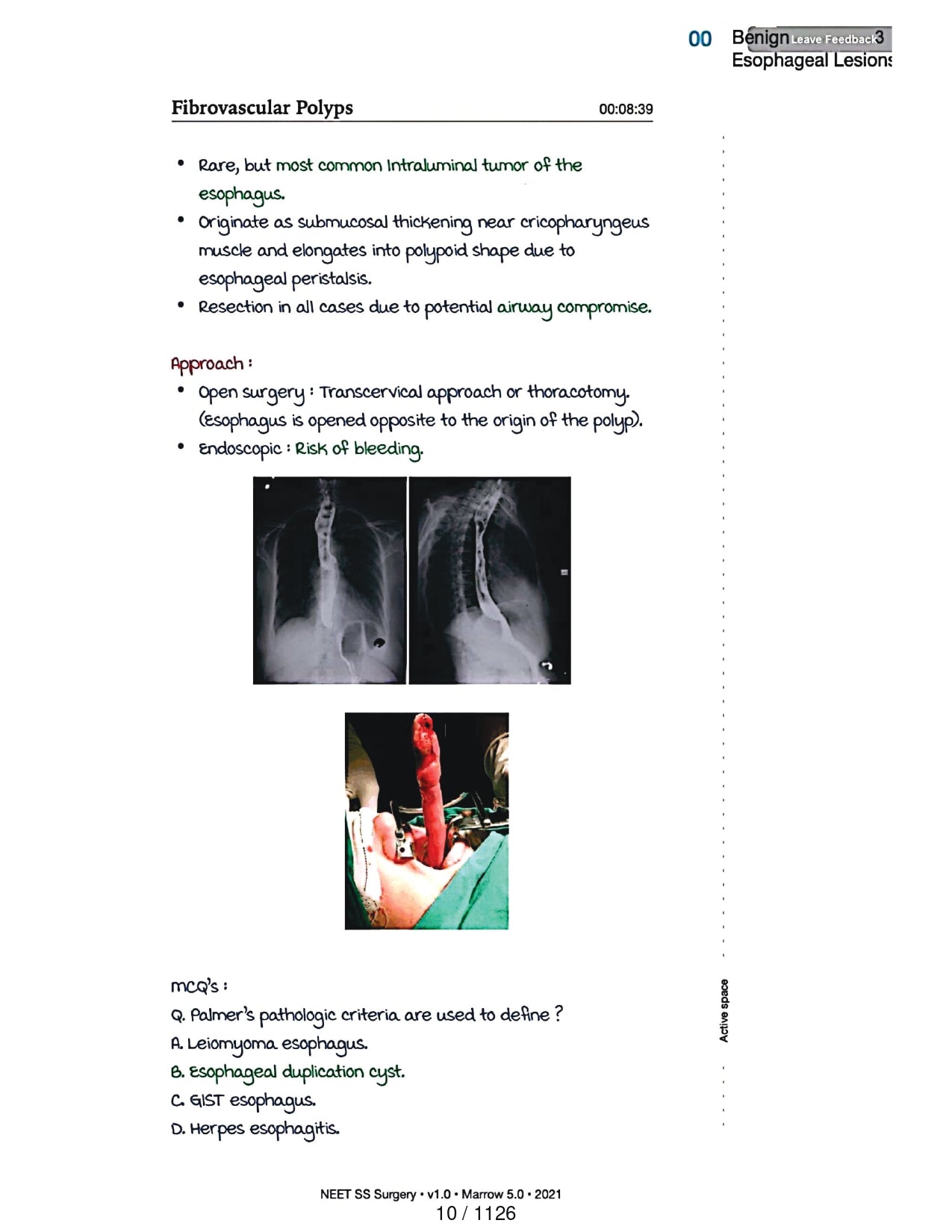 Surgery Neet SS - Gastro Surgery - PrintDoc