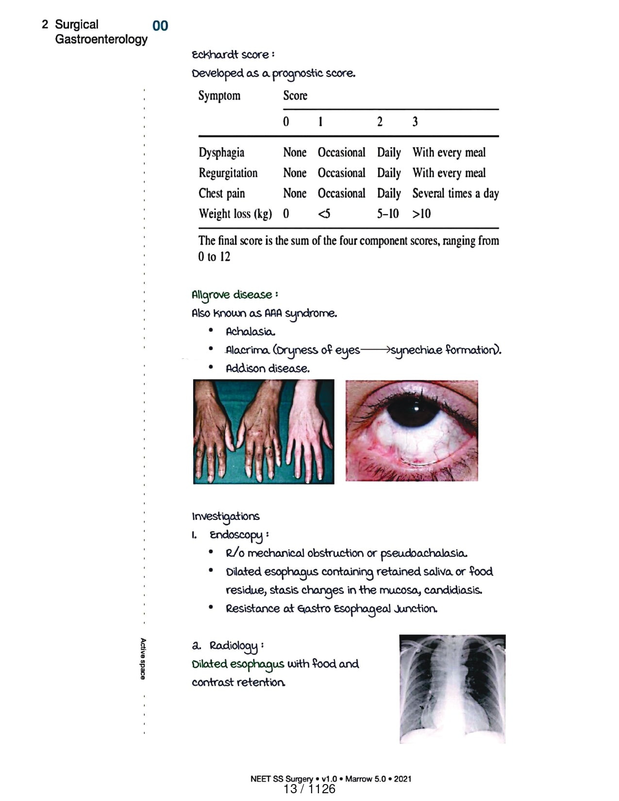Surgery Neet SS - Gastro Surgery - PrintDoc