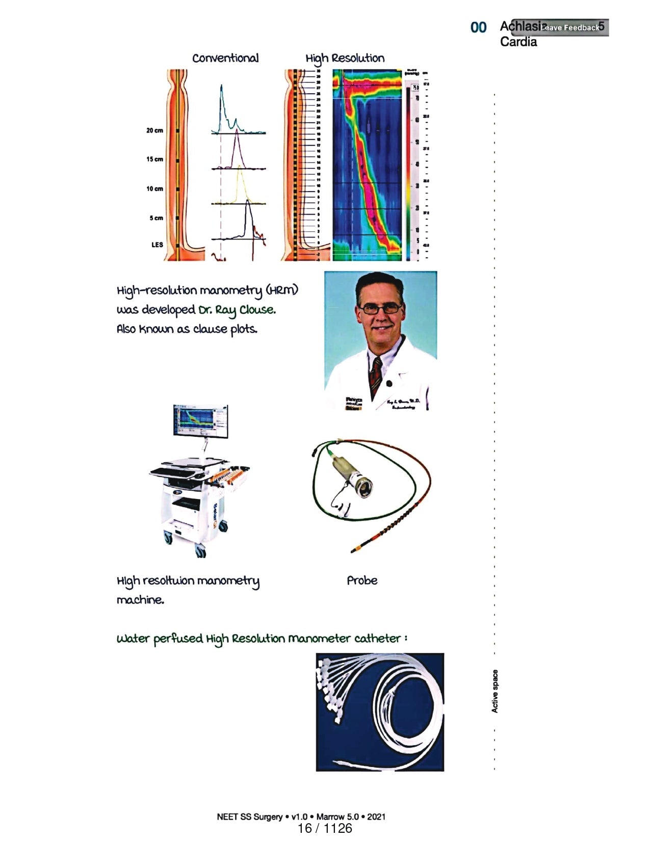 Surgery Neet SS - Gastro Surgery - PrintDoc
