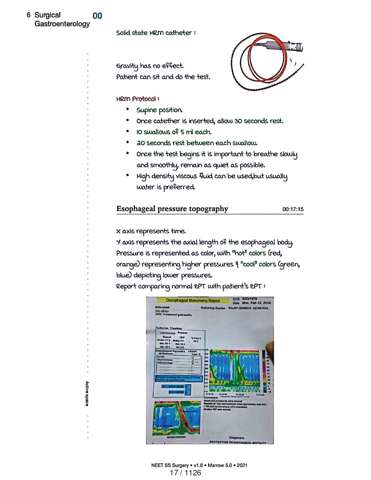 Surgery Neet SS - Gastro Surgery - PrintDoc
