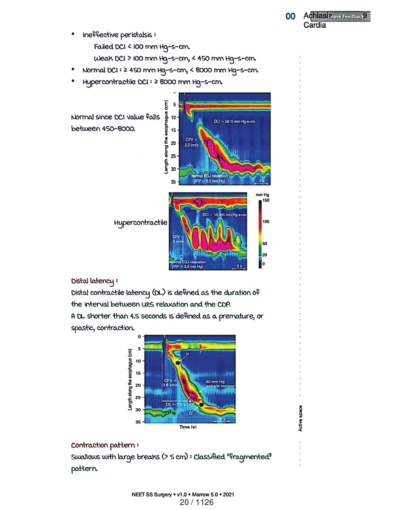 Surgery Neet SS - Gastro Surgery - PrintDoc