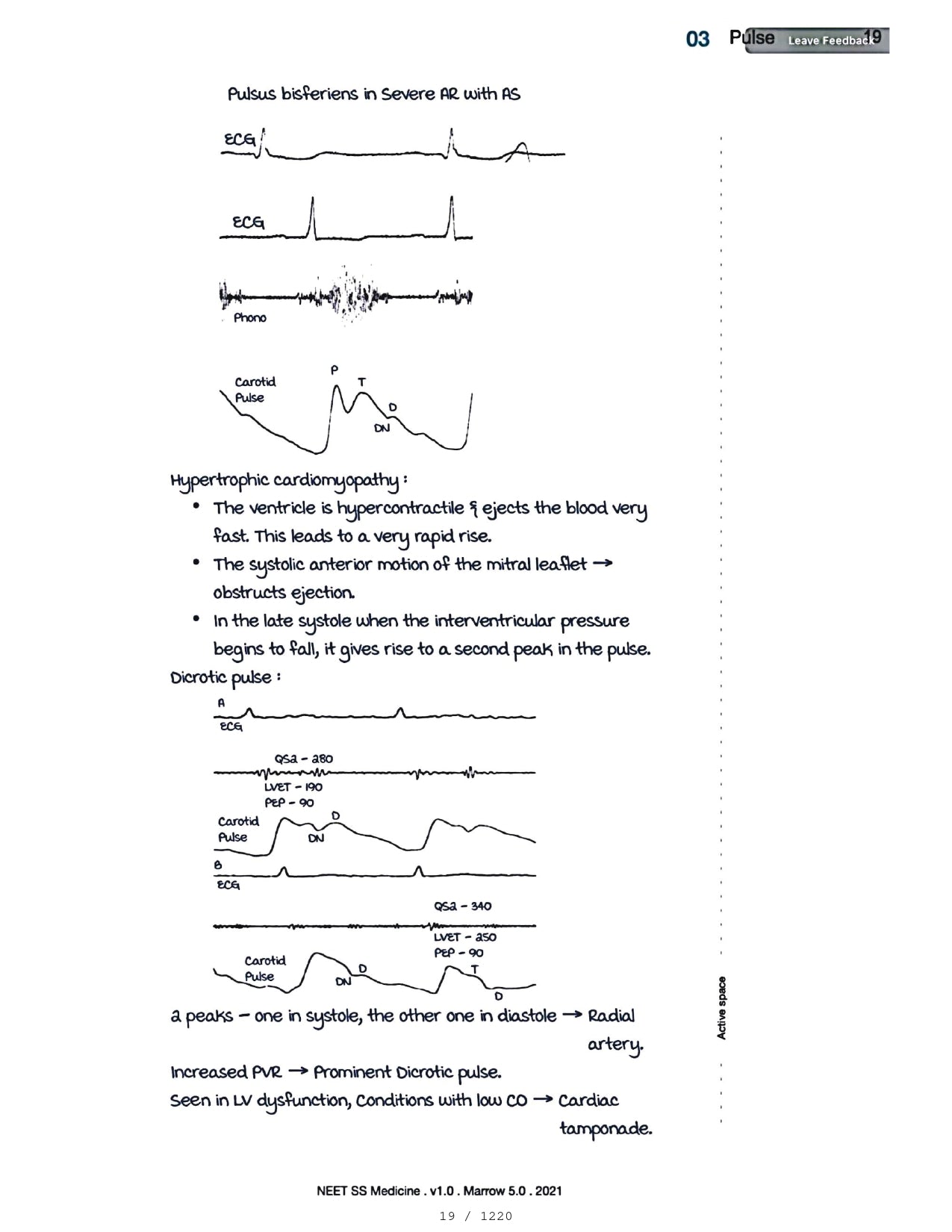 Medicine Neet SS - CARDIOLOGY