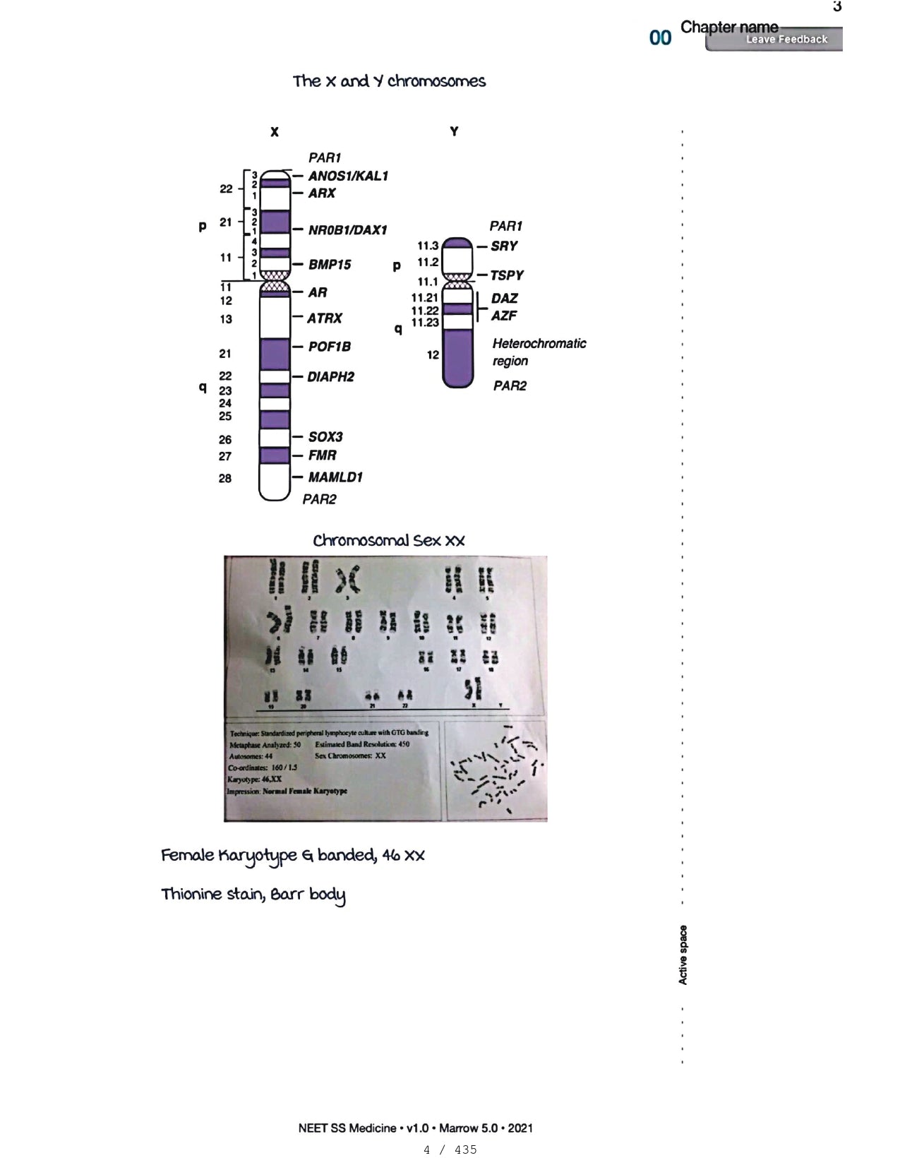 Medicine Neet SS - ENDOCRINOLOGY