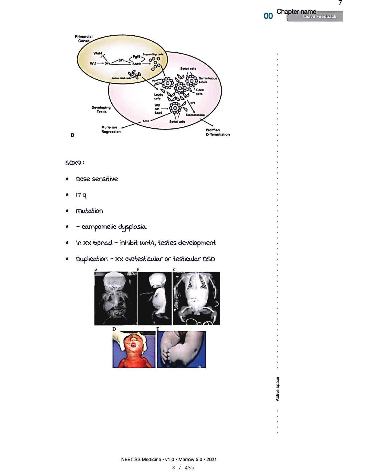 Medicine Neet SS - ENDOCRINOLOGY