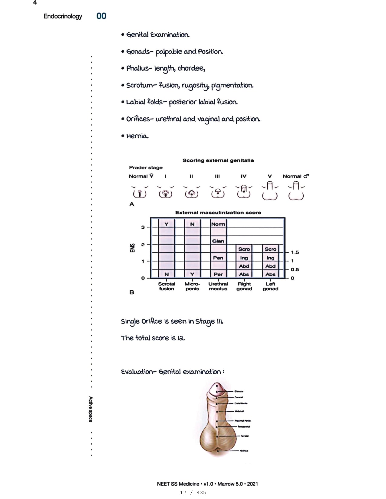 Medicine Neet SS - ENDOCRINOLOGY