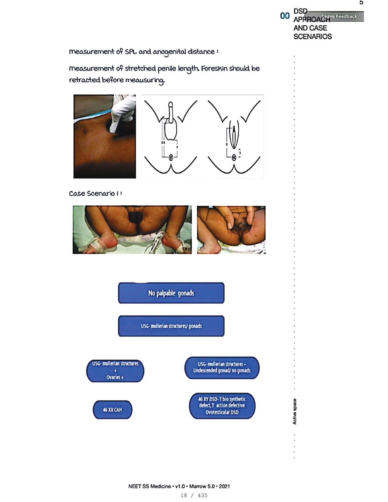 Medicine Neet SS - ENDOCRINOLOGY