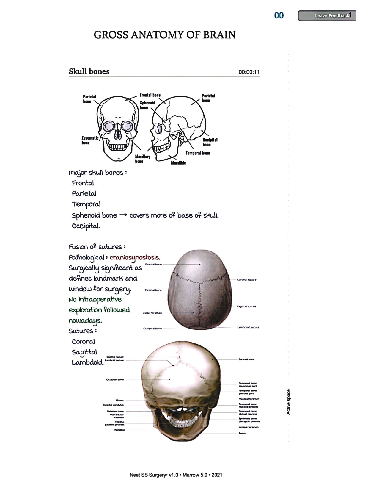 Surgery Neet SS - Neuro Surgery