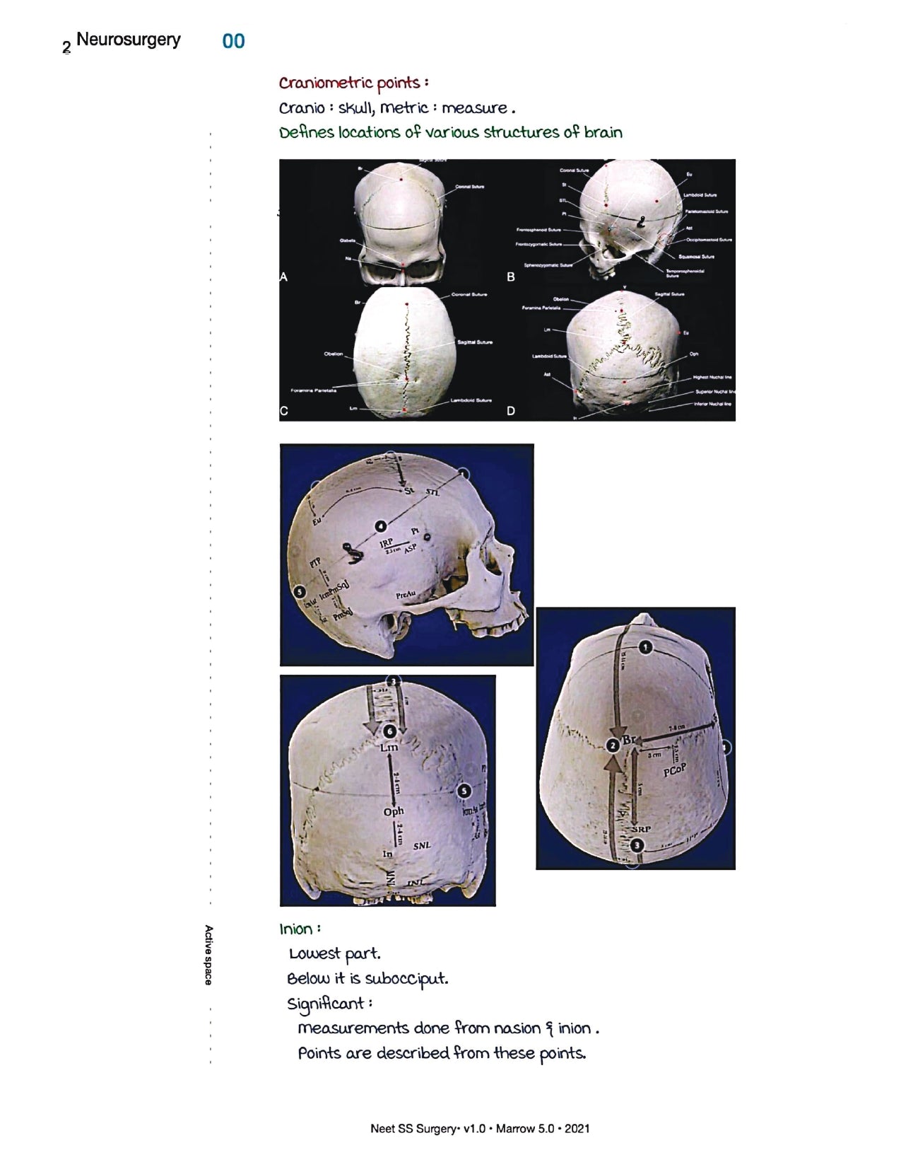 Surgery Neet SS - Neuro Surgery