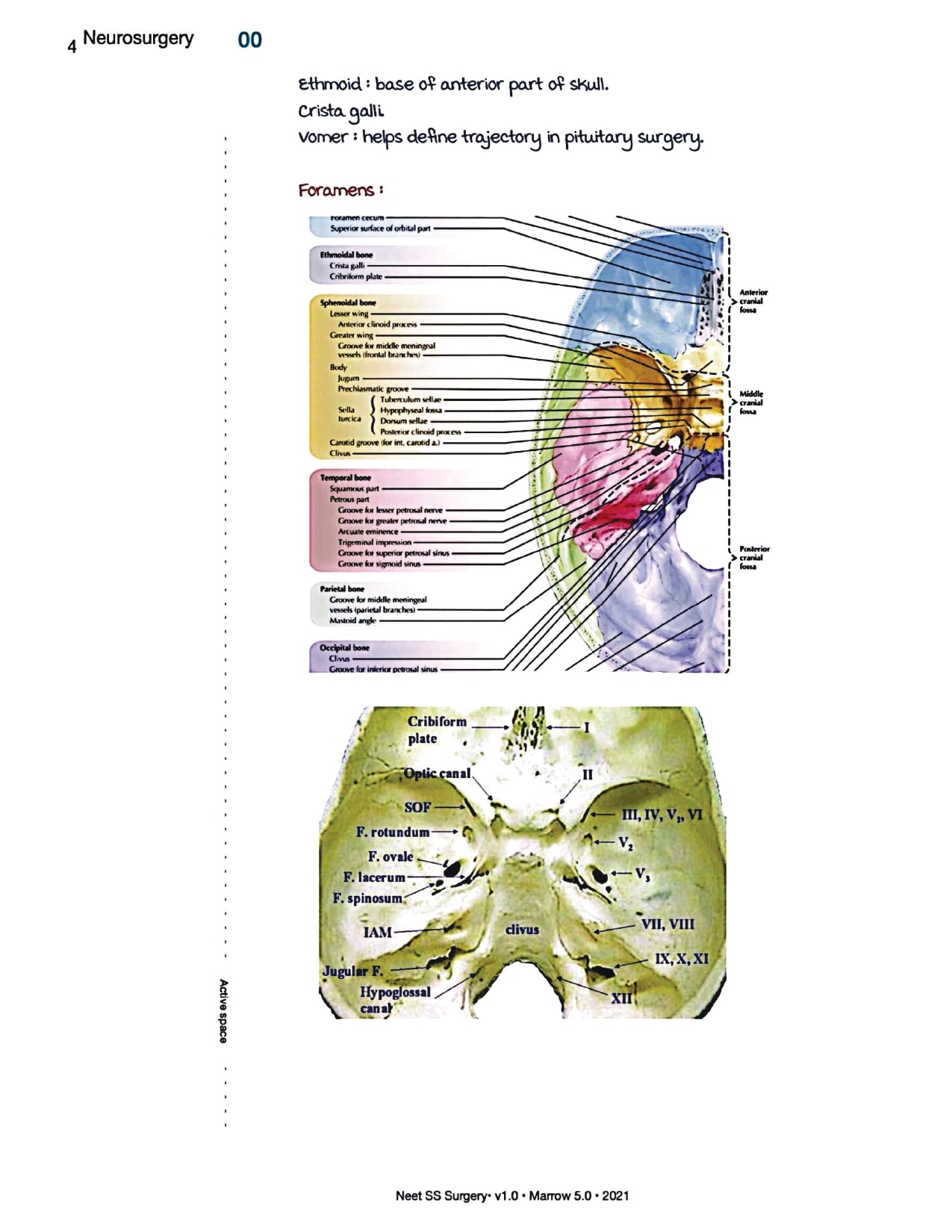 Surgery Neet SS - Neuro Surgery