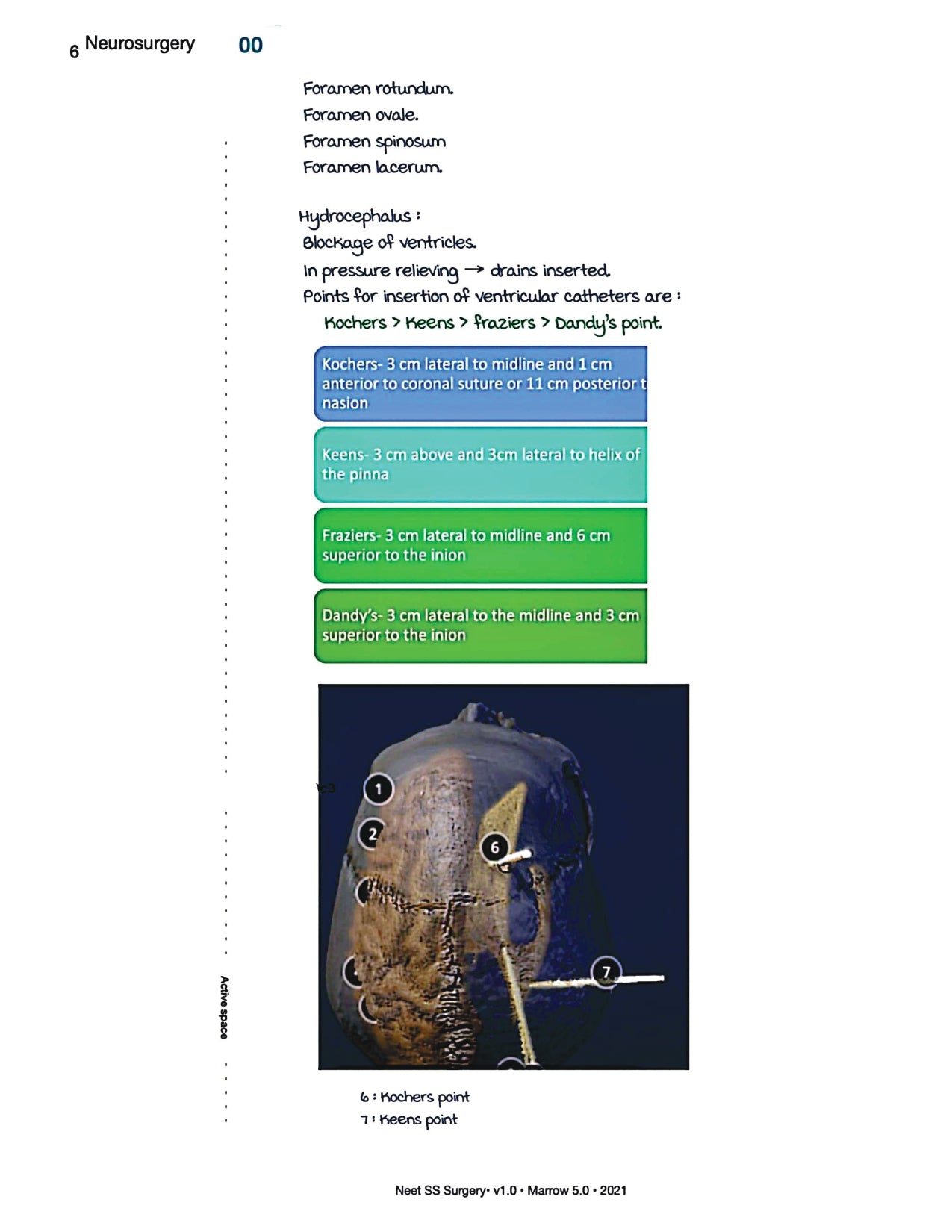 Surgery Neet SS - Neuro Surgery