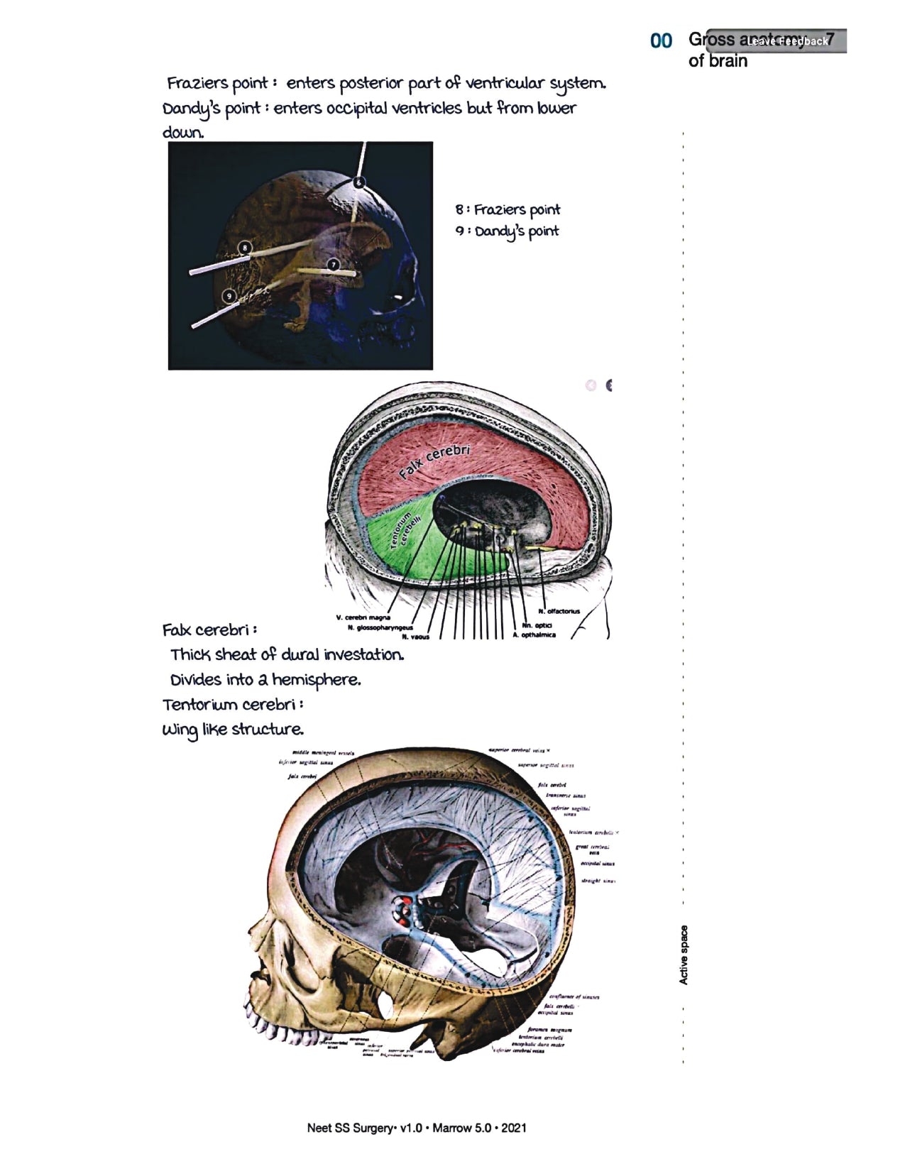 Surgery Neet SS - Neuro Surgery