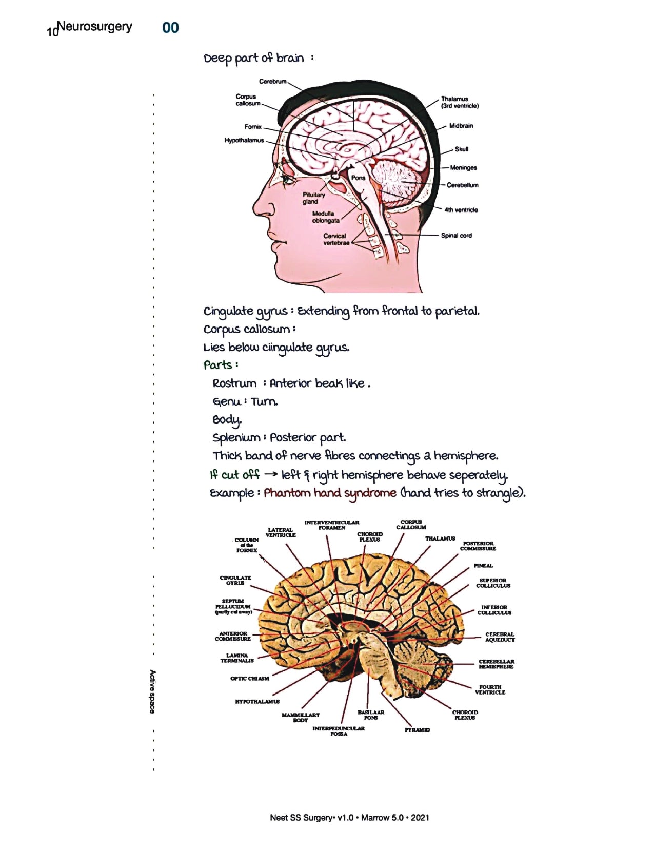 Surgery Neet SS - Neuro Surgery