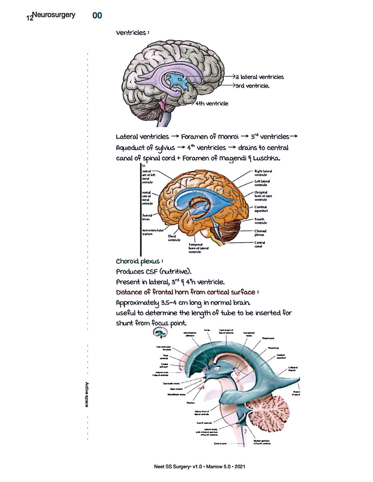 Surgery Neet SS - Neuro Surgery