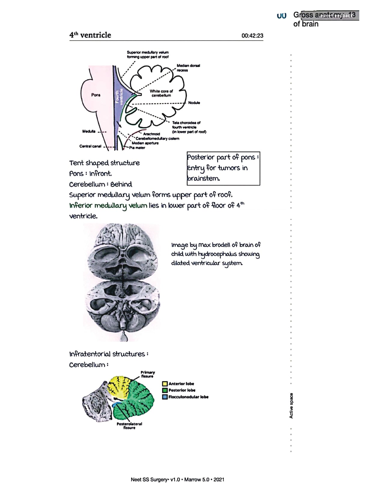 Surgery Neet SS - Neuro Surgery