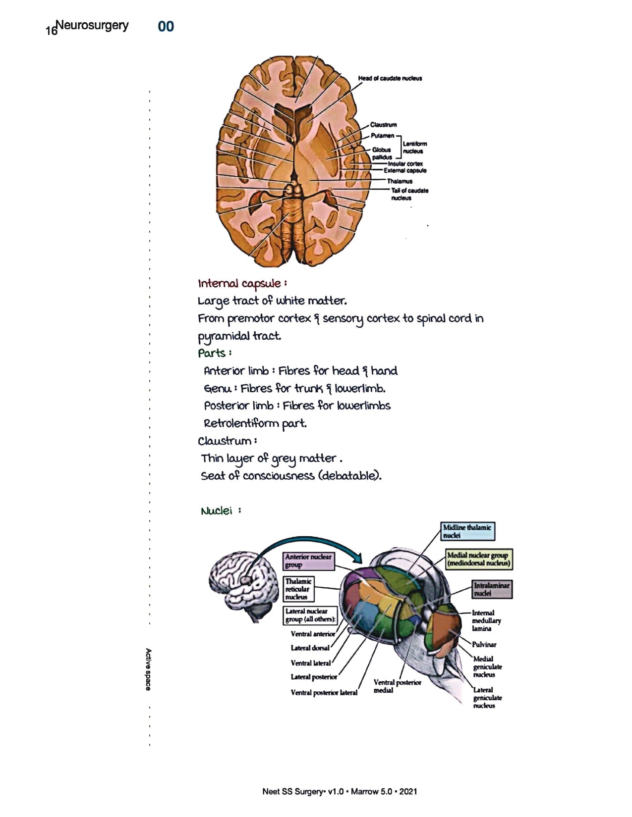 Surgery Neet SS - Neuro Surgery