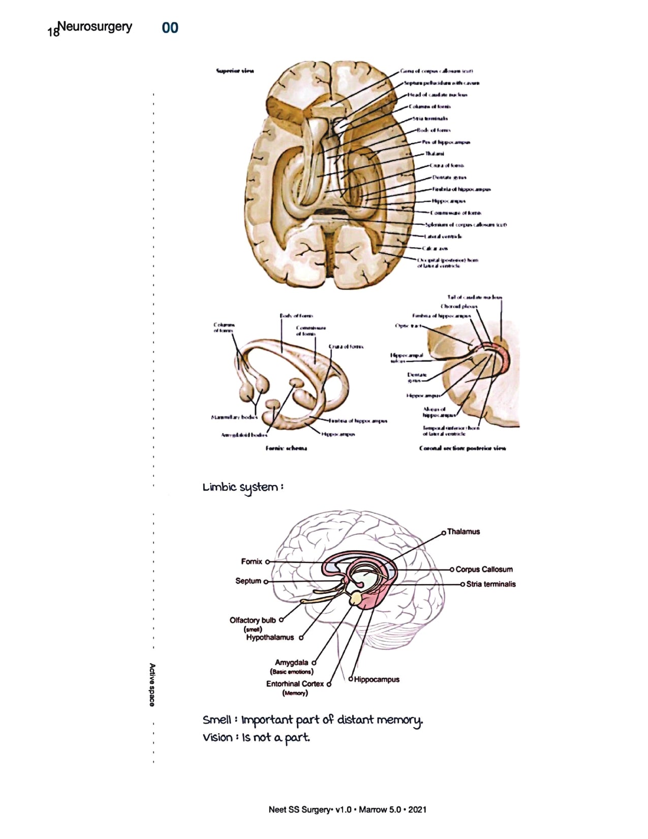 Surgery Neet SS - Neuro Surgery