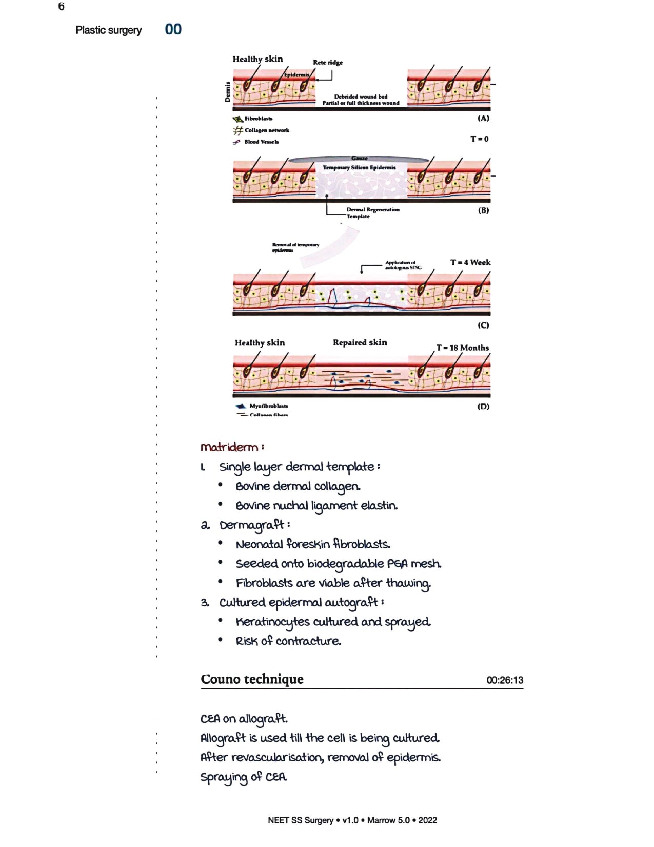 Surgery Neet SS - Plastic Surgery