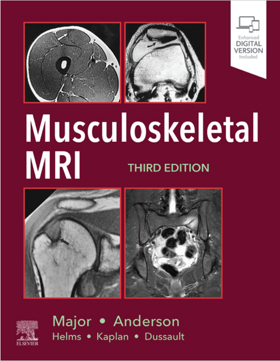 MUSCULOSKELETAL MRI WITH ACCESS CODE 3ED