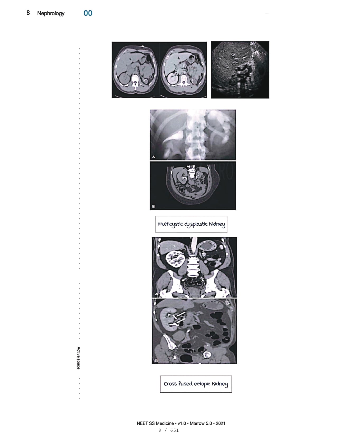 Medicine Neet SS - NEPHROLOGY