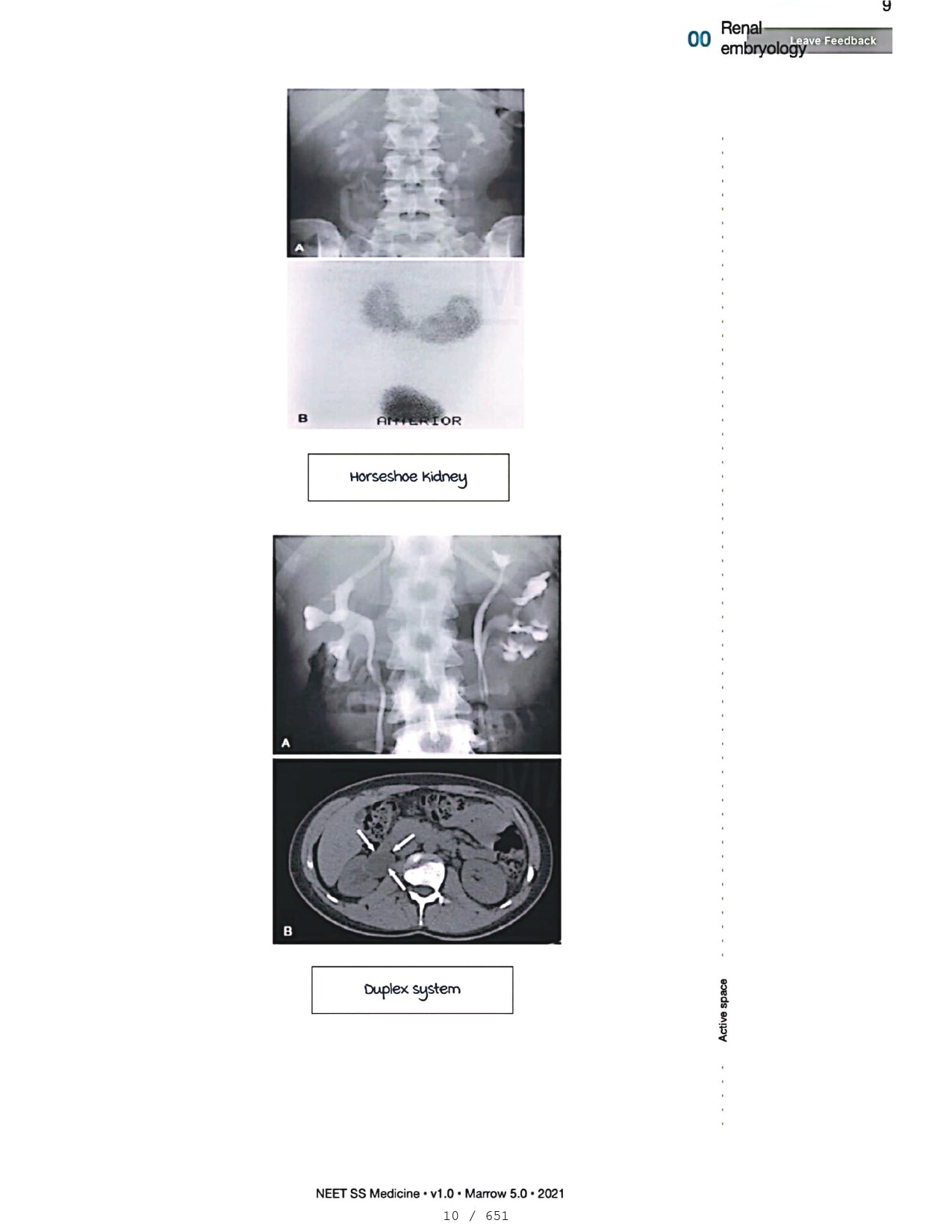 Medicine Neet SS - NEPHROLOGY