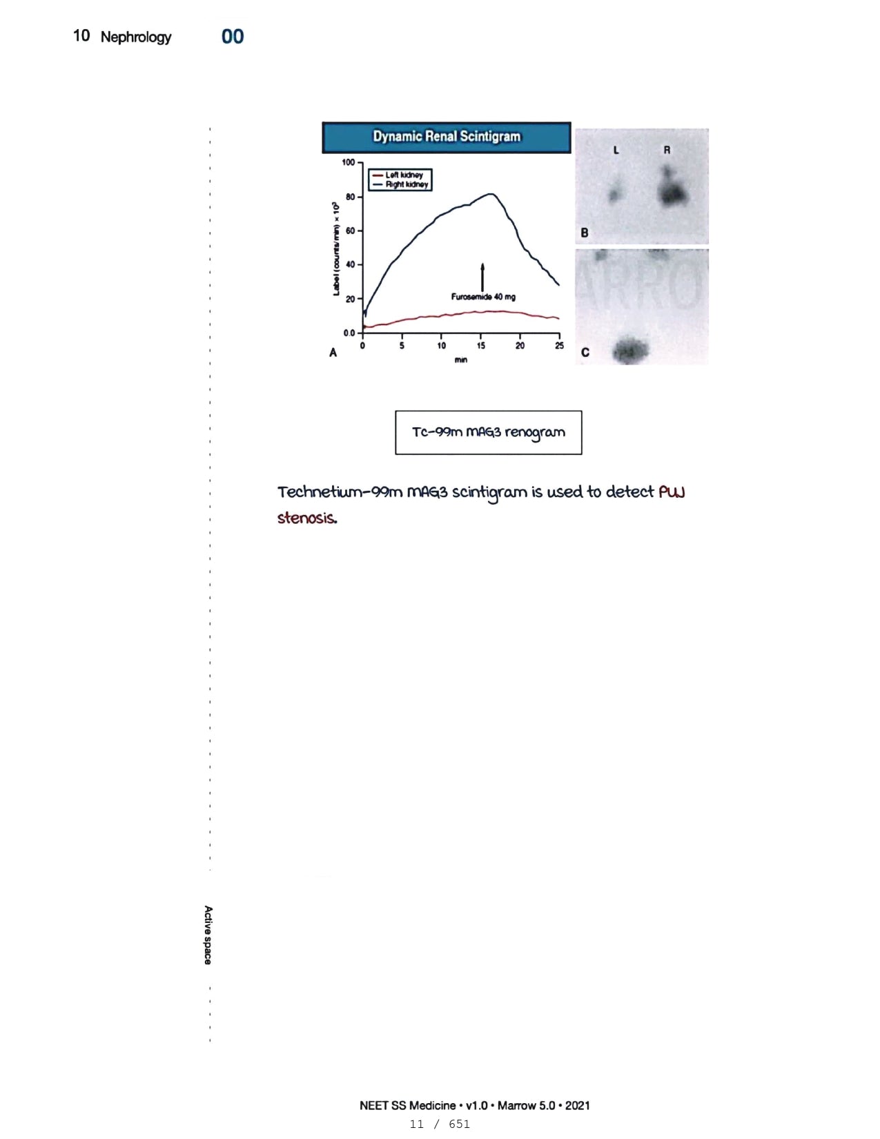 Medicine Neet SS - NEPHROLOGY