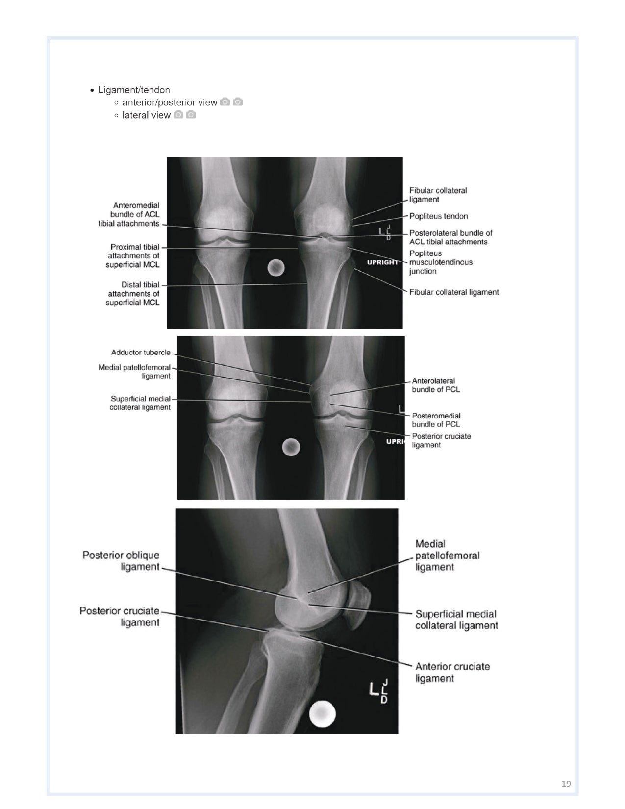 Orthobullets Notes - Vol 1