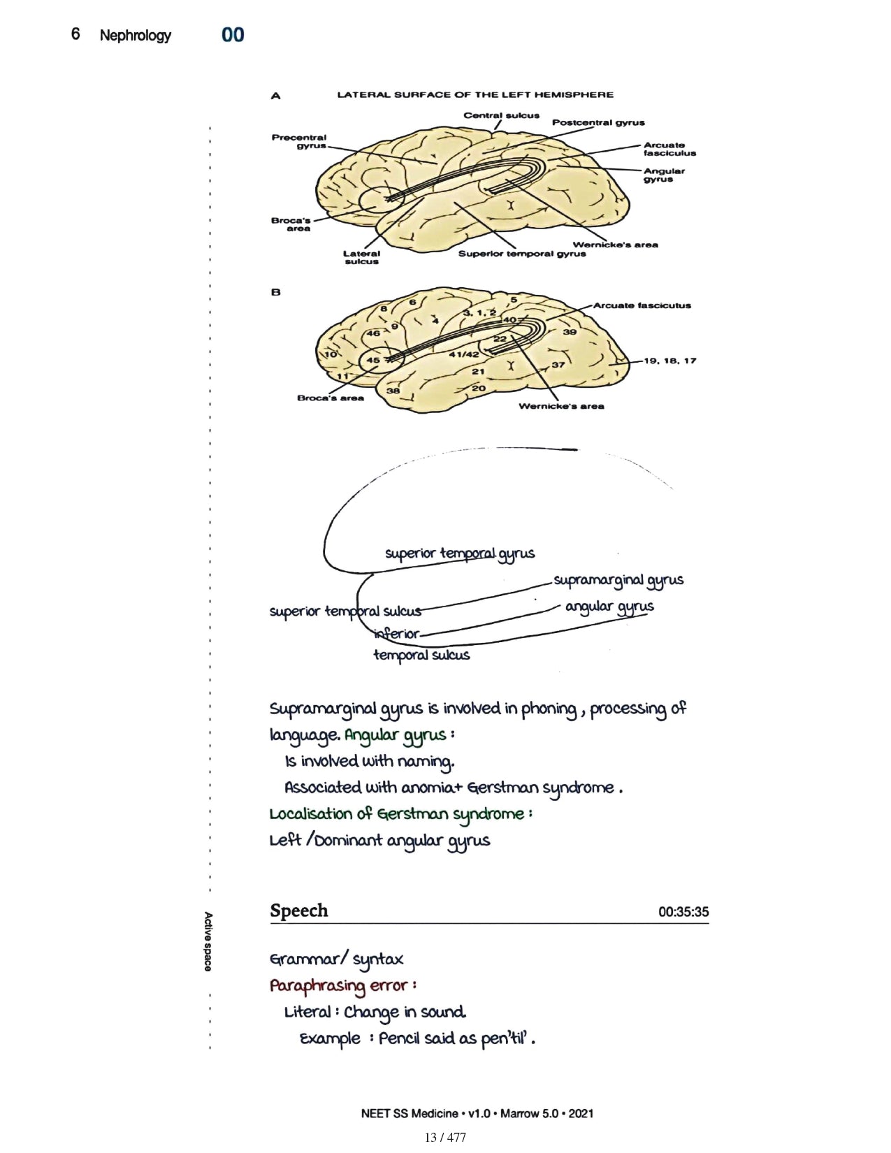 Medicine Neet SS - NEUROLOGY