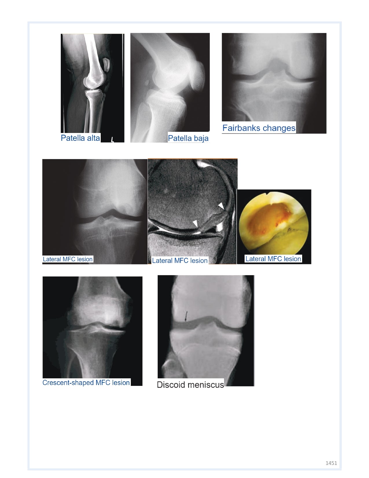 Orthobullets Notes - Vol 2