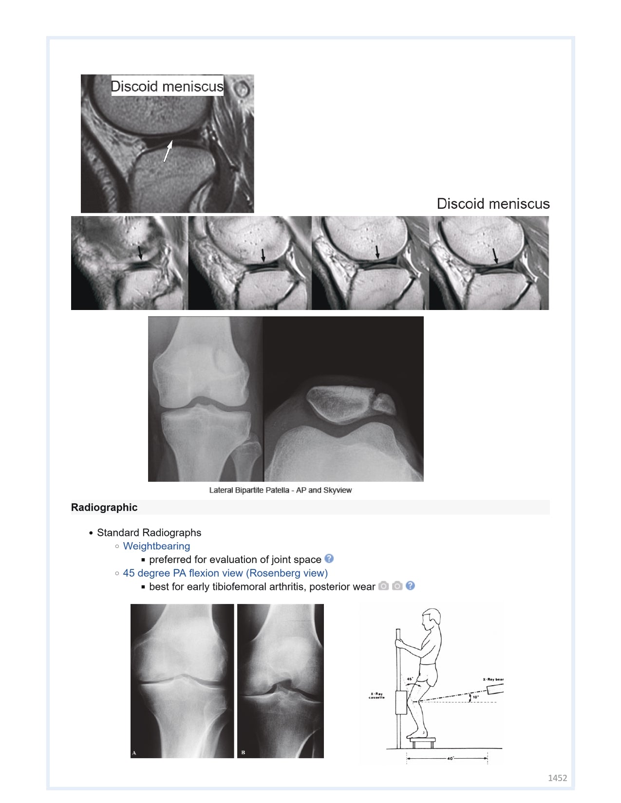 Orthobullets Notes - Vol 2