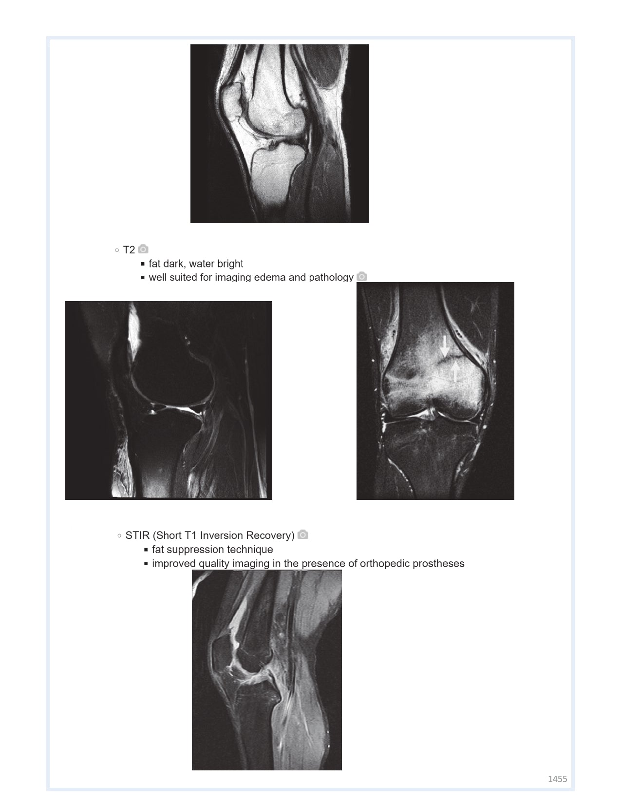 Orthobullets Notes - Vol 2