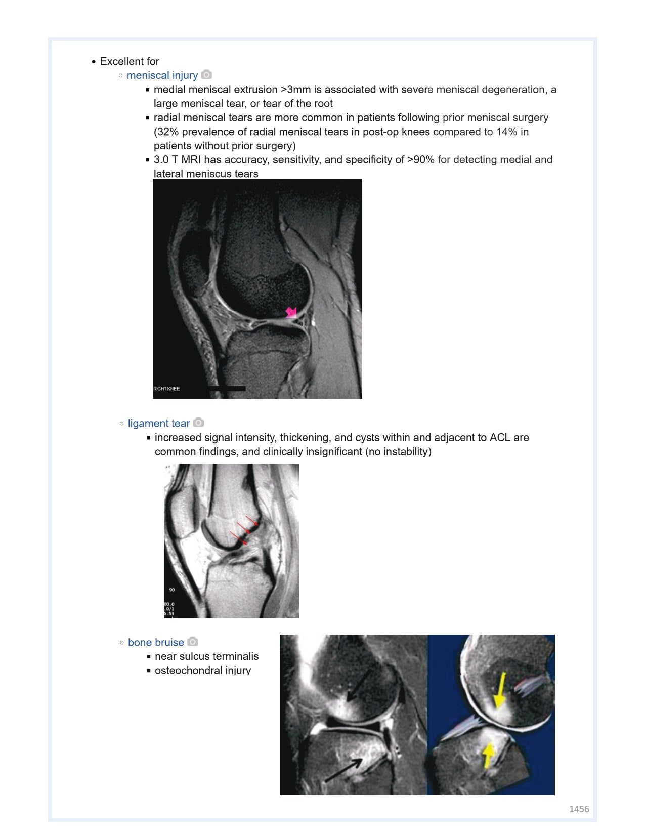 Orthobullets Notes - Vol 2