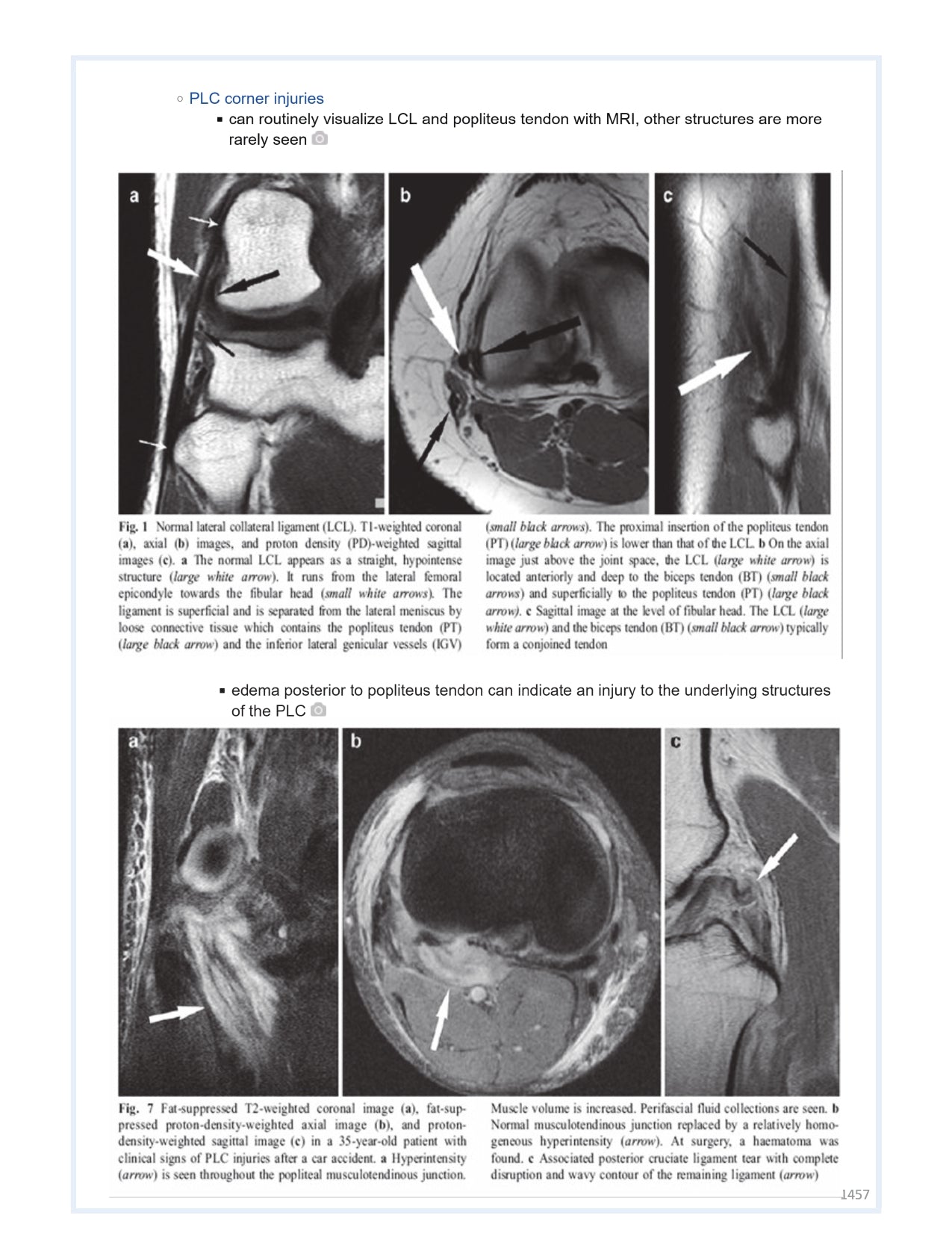 Orthobullets Notes - Vol 2