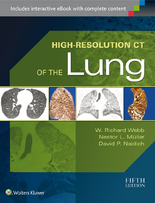 HIGH RESOLUTION CT OF THE LUNG