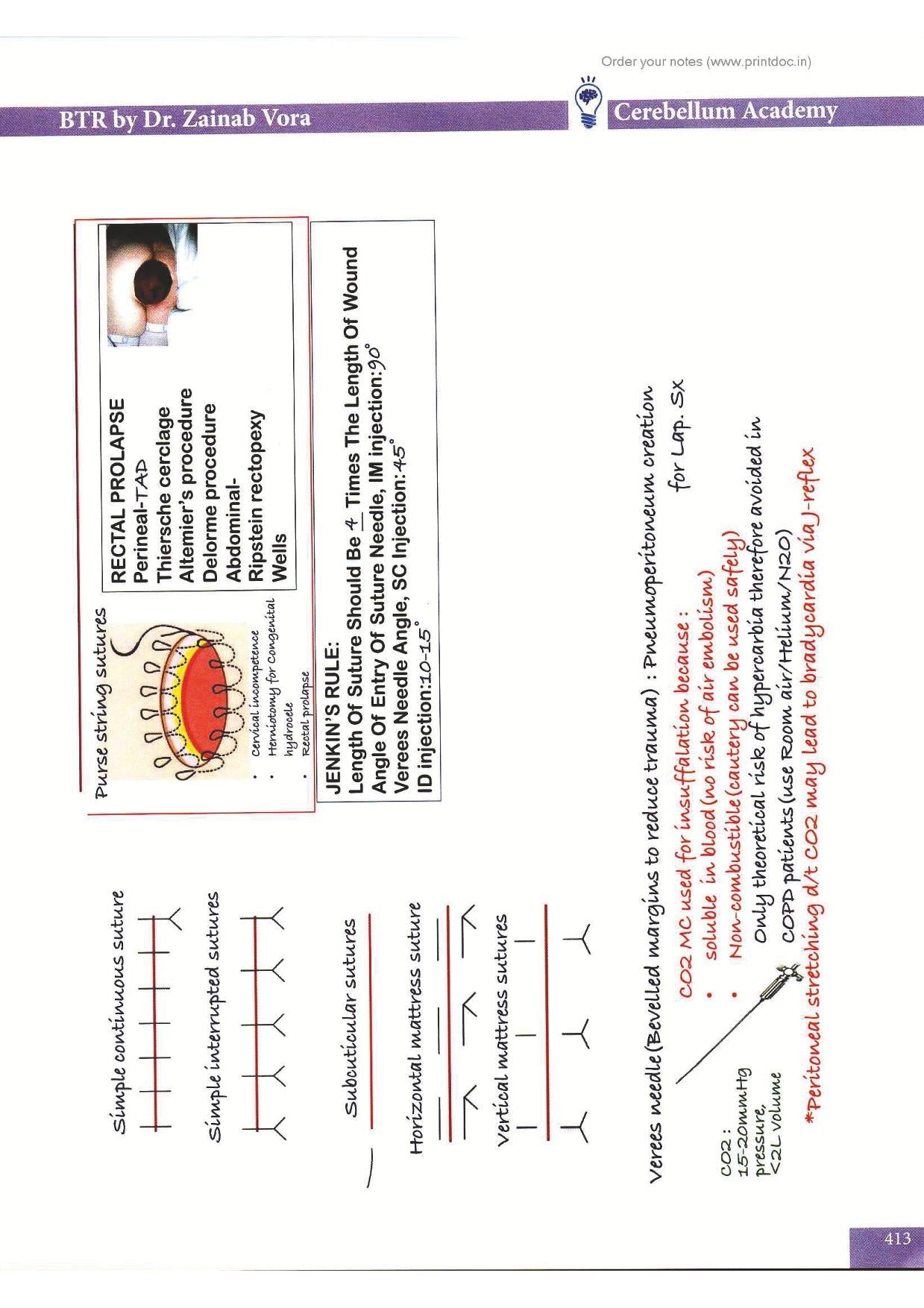 BTR 2.0 Annotated Workbook NEET-PG Notes by Dr. Zainab Vora (New Offer) - PrintDoc