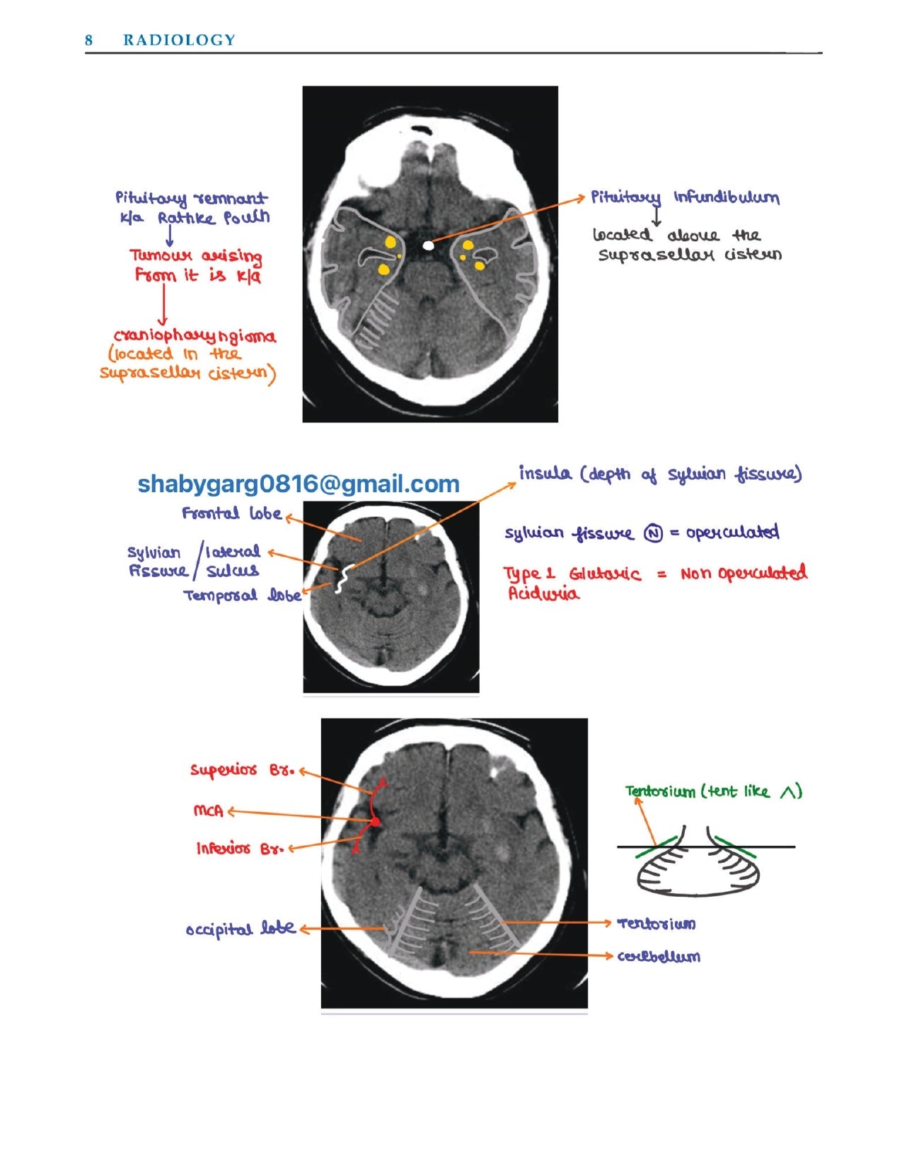 DAMS - RADIOLOGY NOTES 2022-23 - PrintDoc