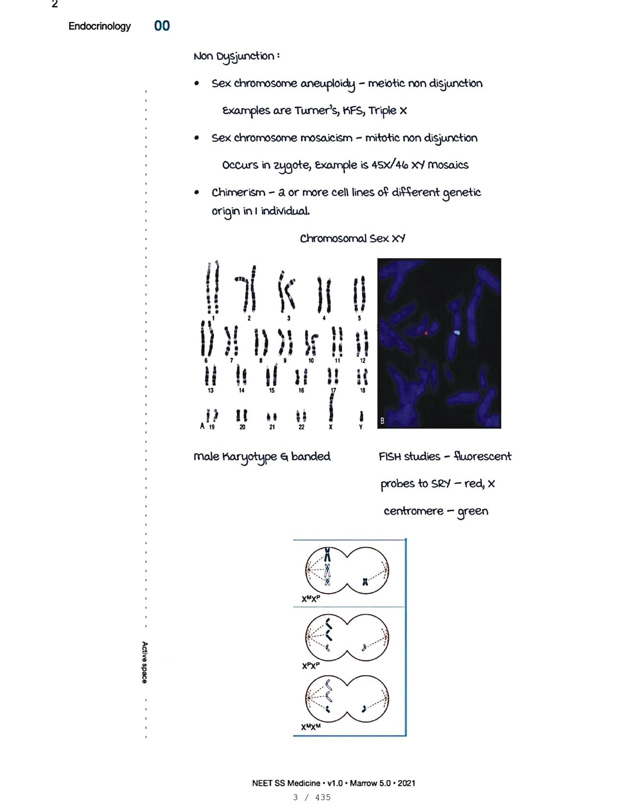 Medicine Neet SS - ENDOCRINOLOGY - PrintDoc