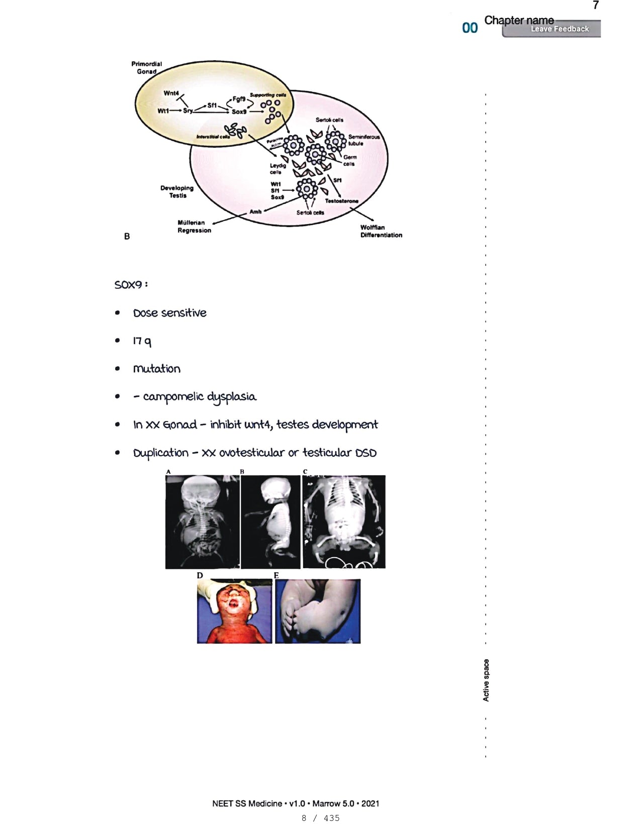 Medicine Neet SS - ENDOCRINOLOGY - PrintDoc