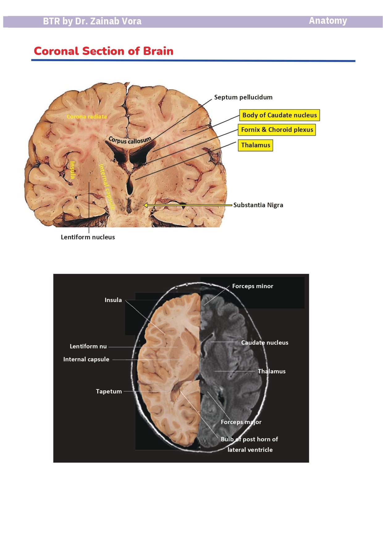 BTR BASED NOTES BY Dr. Ananya Sahoo