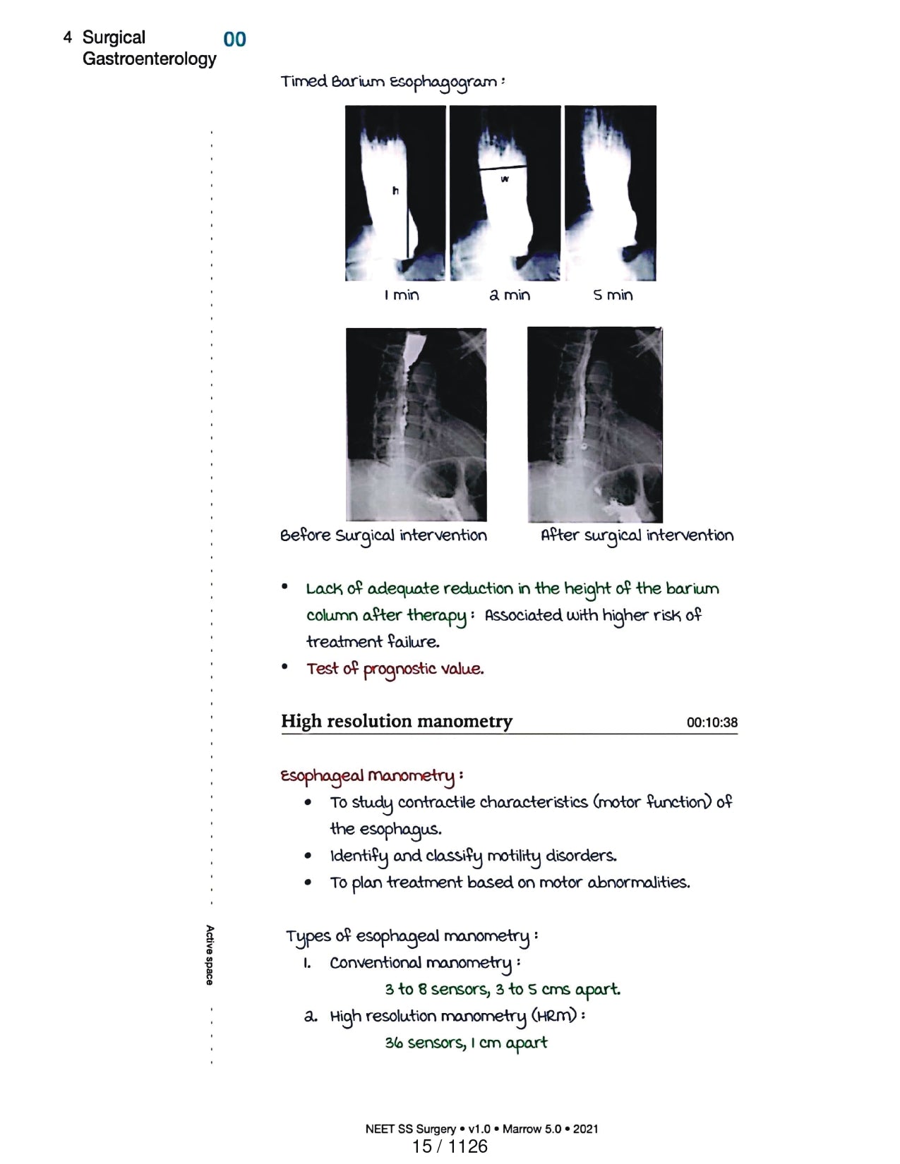 Surgery Neet SS - Gastro Surgery - PrintDoc