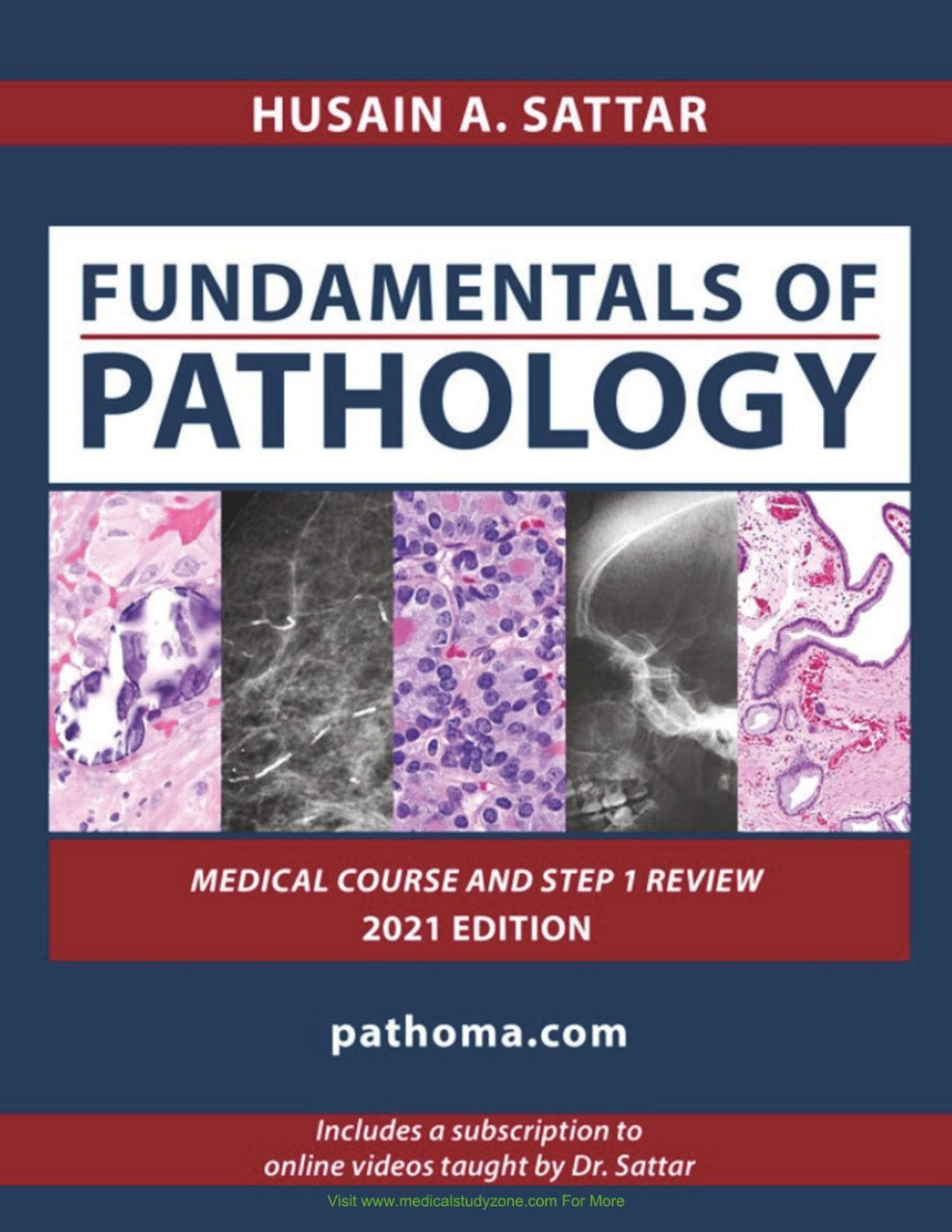 Pathoma Fundamentals of pathology for usmle step 1